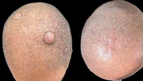 before and after minor surgery