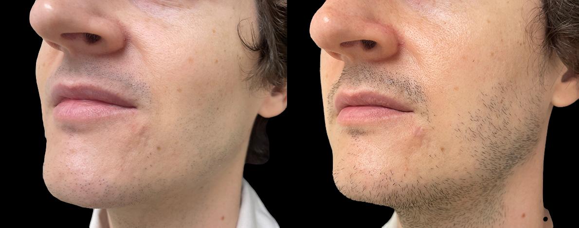 before and after minor surgery