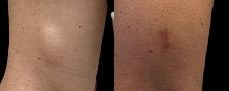 before and after minor surgery
