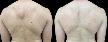 before and after minor surgery