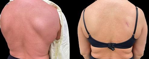 before and after minor surgery