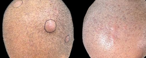 before and after minor surgery