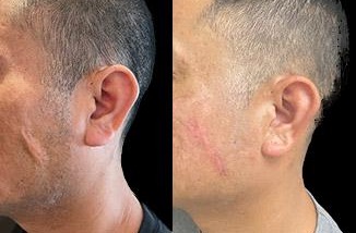 before and after minor surgery